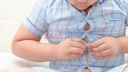 Evidence Suggests Severe Obesity Increasing Among Young US Children