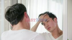 Hair loss: What causes it?