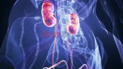 COVID-19 Linked to Increased Risk of Kidney Disease