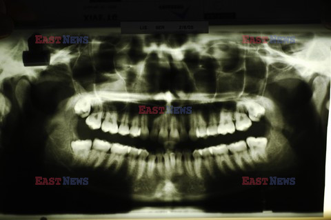 UIG Initial HDD August 2014 Medicimage