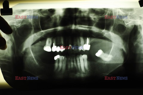 UIG Initial HDD August 2014 Medicimage