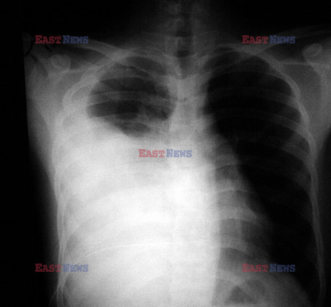 UIG Initial HDD August 2014 Medicimage