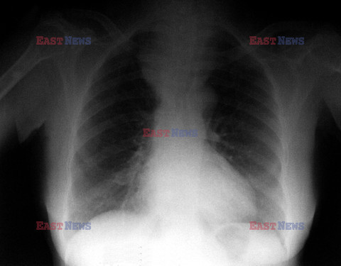 UIG Initial HDD August 2014 Medicimage