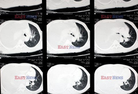 UIG Initial HDD August 2014 Medicimage