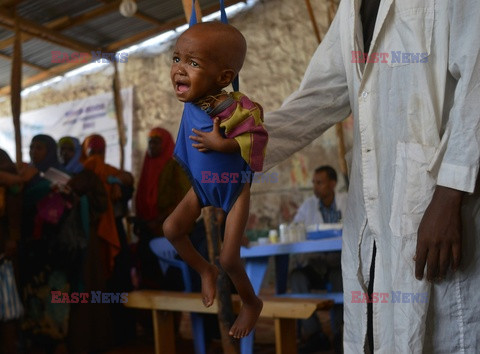 Głód w Somalii - AFP