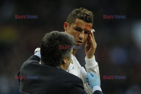 Zakrwawiony Ronaldo i zmartwiona Georgina