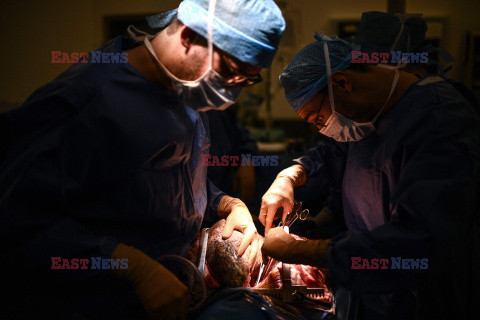 Transplantologia we Francji - AFP