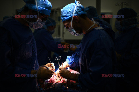 Transplantologia we Francji - AFP