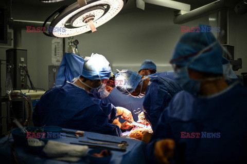 Transplantologia we Francji - AFP