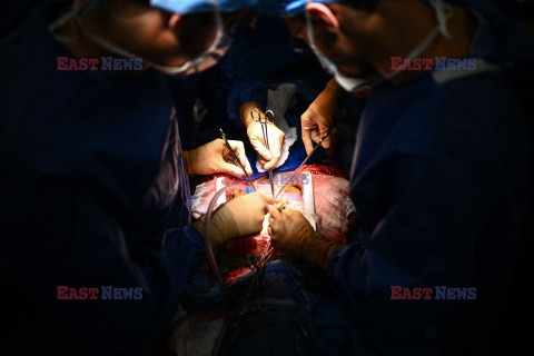 Transplantologia we Francji - AFP