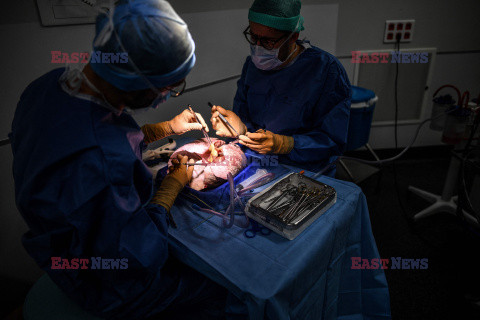 Transplantologia we Francji - AFP