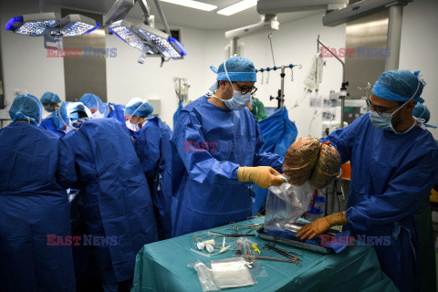 Transplantologia we Francji - AFP