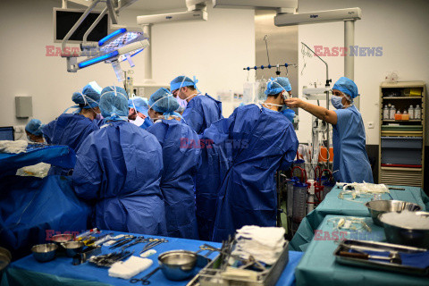 Transplantologia we Francji - AFP