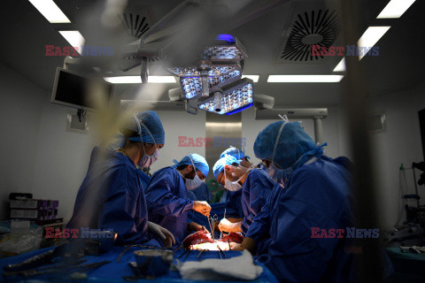 Transplantologia we Francji - AFP