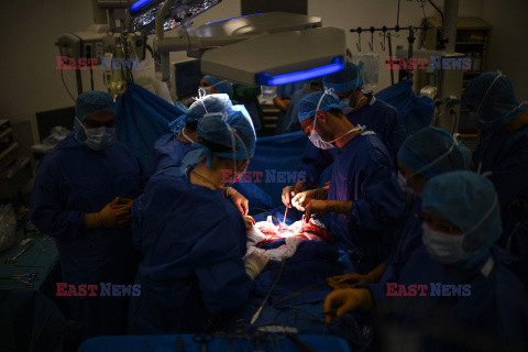 Transplantologia we Francji - AFP