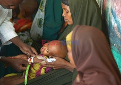 Głód w Somalii - AFP