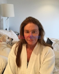 Caitlyn Jenner chwali się operacją nosa