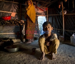 Bangladesz - obóz dla ludu Rohingya - Vu Images