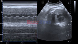 SPL RF May 2022