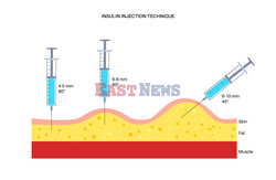 SPL RF Sep 2022