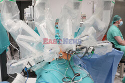 Operacja robotyczna resekcji przełyku w WIM